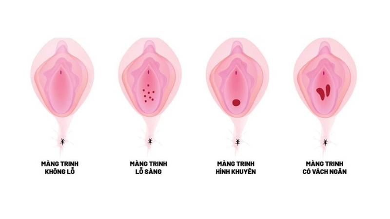 Chưa rách màng trinh có thai được không? Sự thật nhiều người muốn biết 2