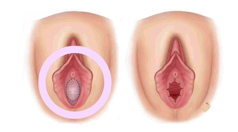 Chưa rách màng trinh có thai được không? Sự thật nhiều người muốn biết 1