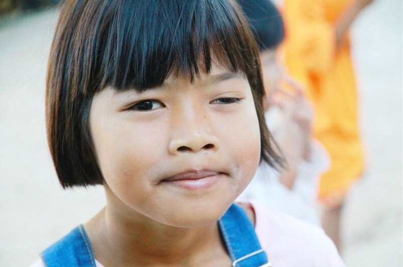 Chữa sụp mí bẩm sinh tại nhà bằng cách nào hiệu quả 3