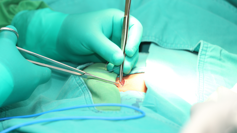 Các phương pháp phẫu thuật điều trị thoát vị bẹn phổ biến hiện nay