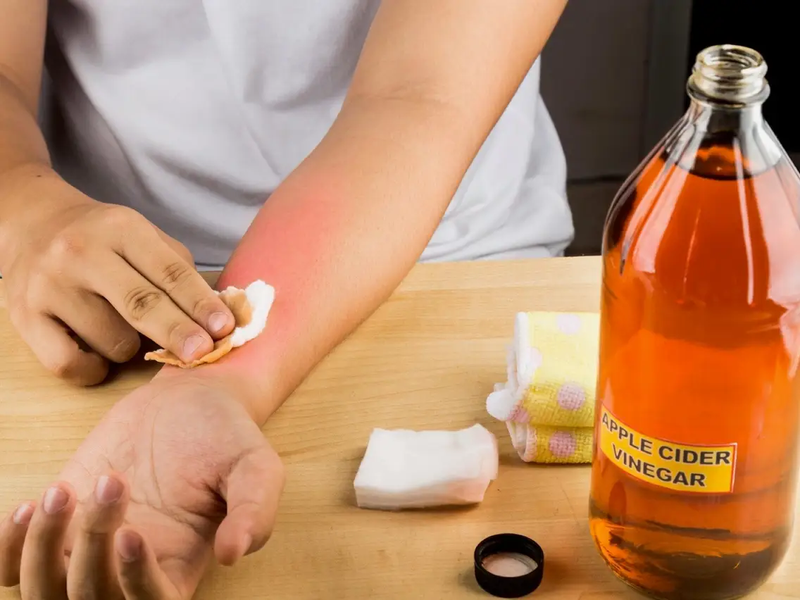 chữa tổ đỉa bằng giấm táo 3