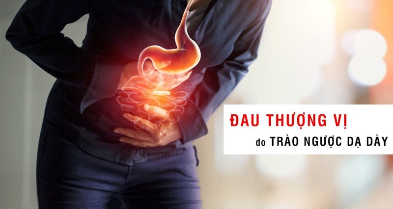 chữa trào ngược dạ dày thực quản bằng đông y 1
