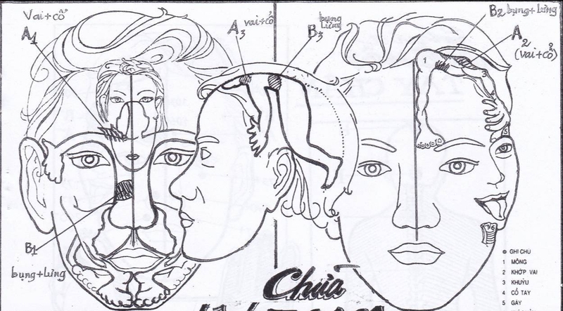 Chữa zona thần kinh bằng diện chẩn như thế nào? 3