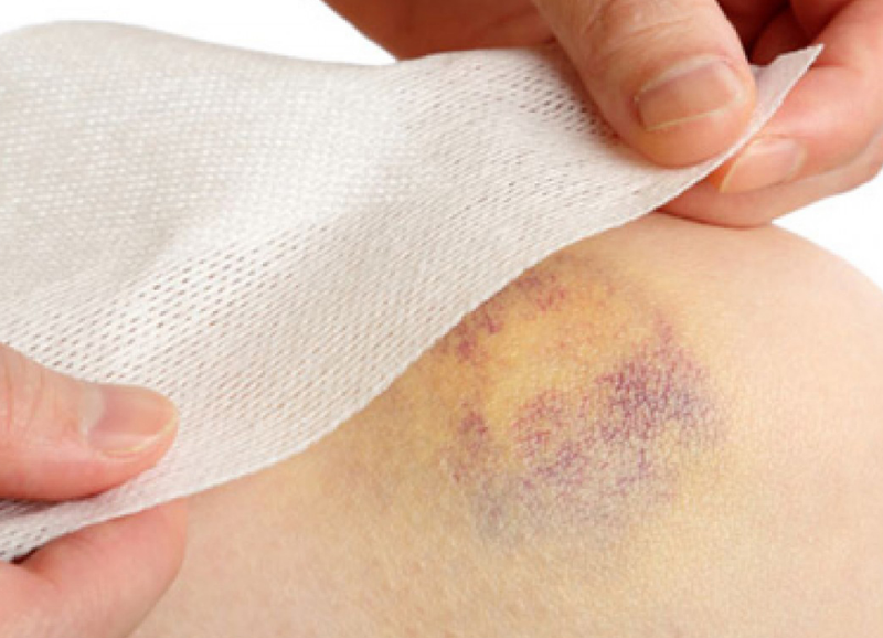 Chức năng của tiểu cầu ảnh hưởng đến quá trình cầm máu thế nào? 2