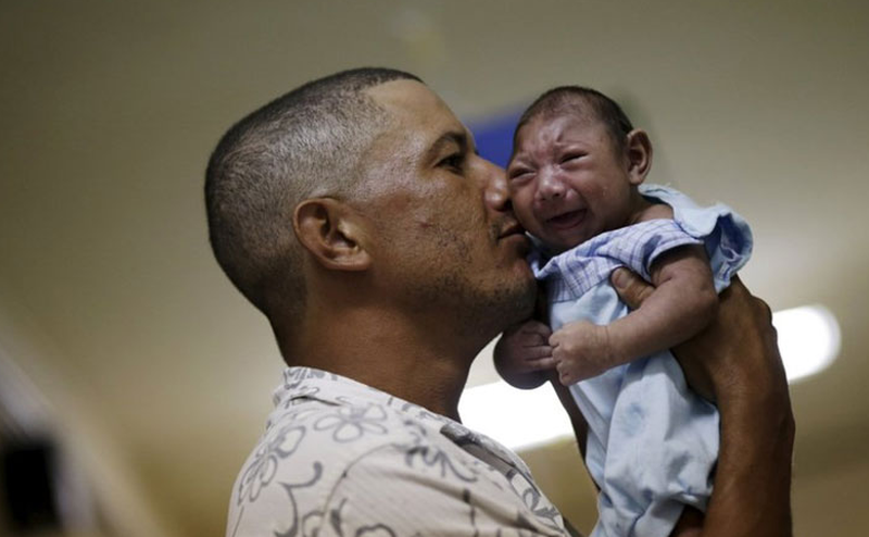 Trẻ tật đầu nhỏ cần có chế độ sinh hoạt phù hợp