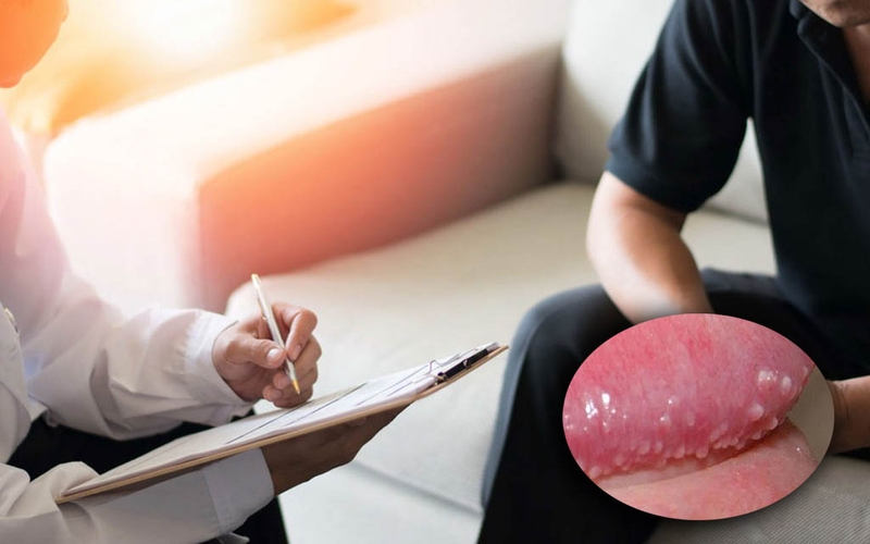 Chuỗi hạt ngọc dương vật xếp thành hàng có màu trắng, sáng bóng