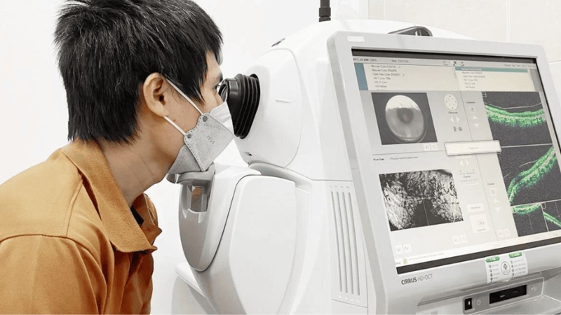 Nhiều người quan tâm&nbsp;chụp OCT mắt bao nhiêu tiền