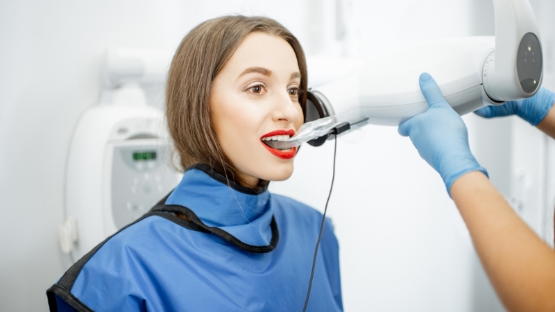 Chụp X-quang răng tương đối an toàn khi thực hiện đúng chỉ định và quy trình