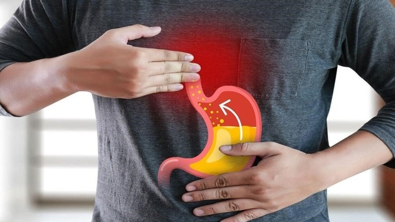 Chụp cắt lớp dạ dày có nguy hiểm không? Những điều cần biết 2