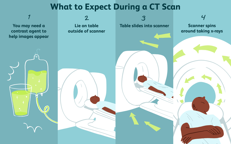 Chụp cắt lớp điện toán: Quy trình, thời gian và ưu, nhược điểm 3