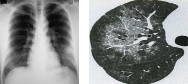 chup-cat-lop-vi-tinh-phoi-de-lam-gi-va-khi-nao-nen-thuc-hien 1