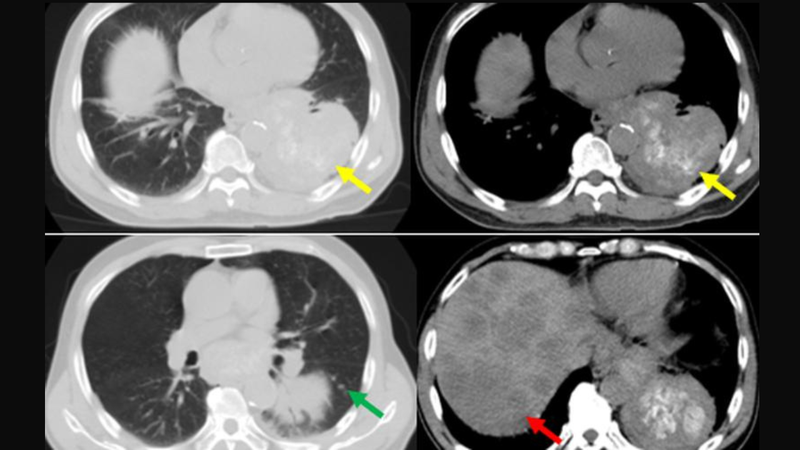 chup-cat-lop-vi-tinh-phoi-de-lam-gi-va-khi-nao-nen-thuc-hien 2