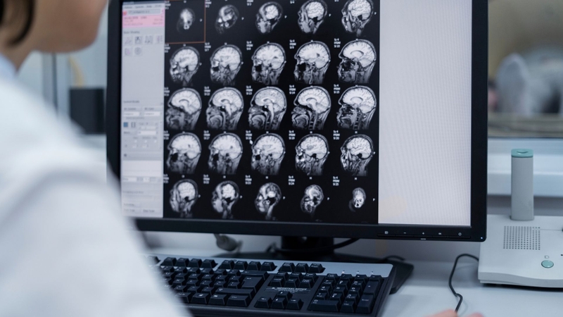 Những điều cần biết trước, trong và sau khi chụp MRI 3.0 Tesla
