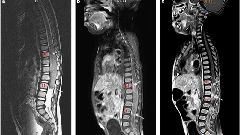 Chụp cộng hưởng từ cho trẻ em - Ảnh hưởng như thế nào đến sức khoẻ? 3