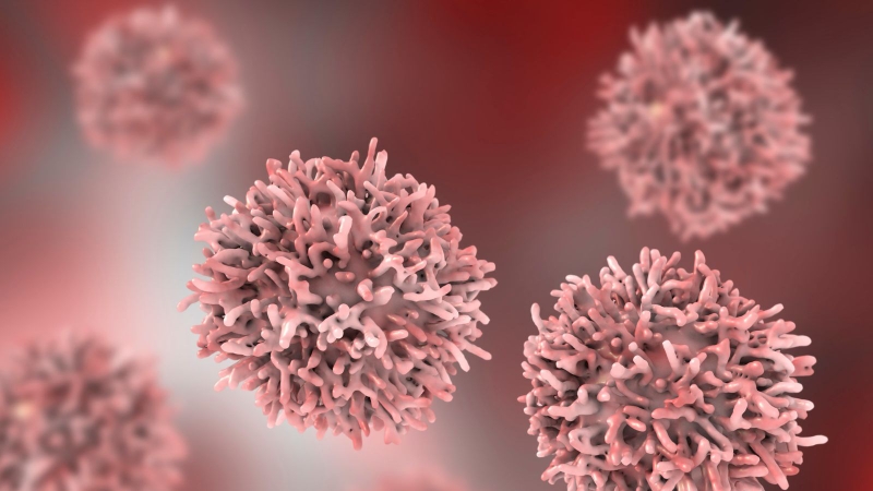 Chụp cộng hưởng từ có phát hiện ung thư không? 2