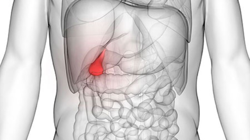 Chụp cộng hưởng từ mật tụy MRCP và những điều bạn cần biết 1