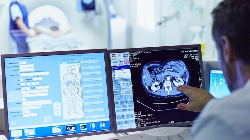 chup-ct-co-hai-khong-chup-ct-tac-dong-den-co-the-nhu-the-nao 1