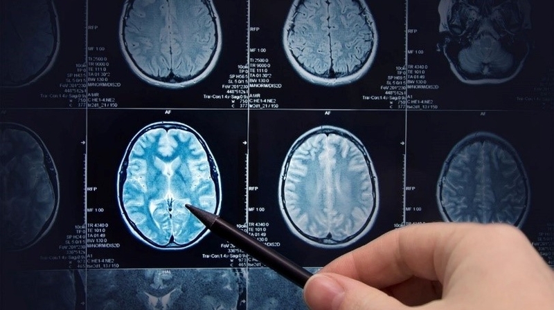 chup-ct-co-hai-khong-chup-ct-tac-dong-den-co-the-nhu-the-nao 3