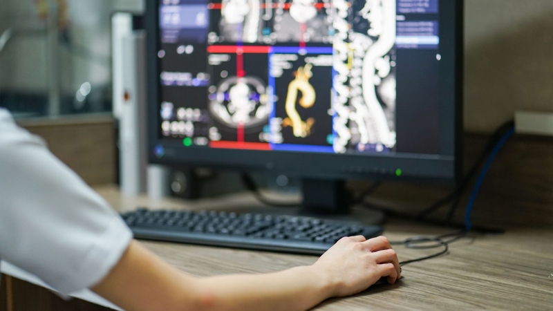 Những thông tin cơ bản về phương pháp chụp CT cột sống thắt lưng 2