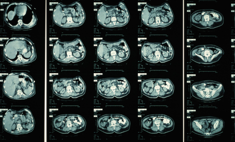 Chụp CT đầu cho trẻ có hại không? Quy trình chụp an toàn cho trẻ 1