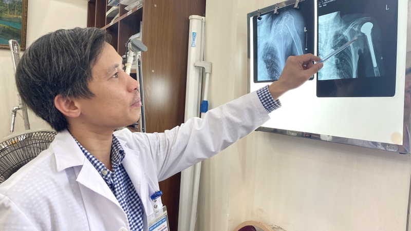 Chụp CT u phổi và quy trình thực hiện cơ bản 4