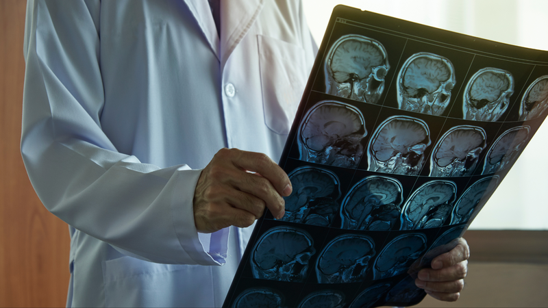 Sau khi có kết quả MRI, bác sĩ sẽ đọc và đánh giá hình ảnh