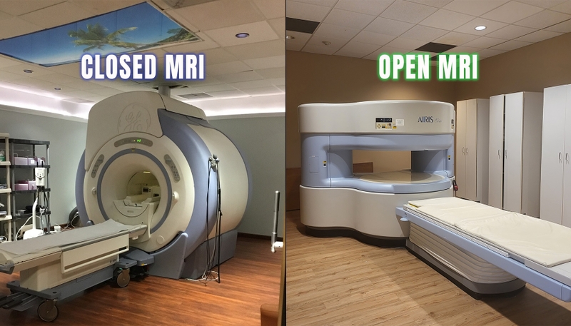 Khám phá công nghệ chụp MRI mở: Cải tiến đột phá trong lĩnh vực y tế 1