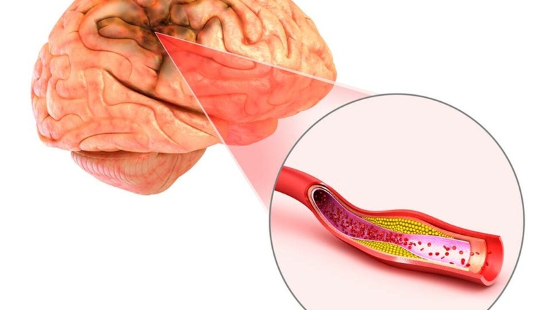 Chụp mri não bao nhiêu tiền, có đắt không? 2