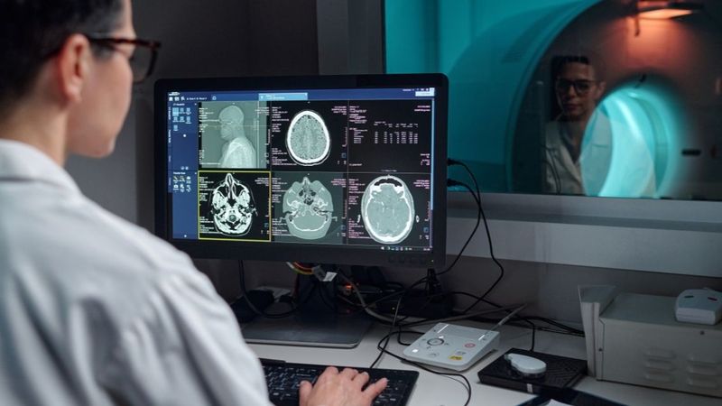 Quy trình chụp MRI não giúp bác sĩ quan sát rõ nhu mô não