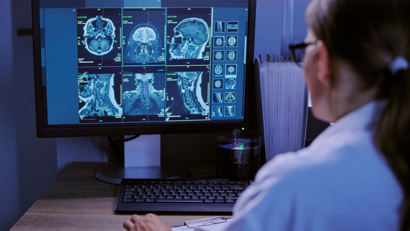 Kỹ thuật MRI sọ não cho phép đánh giá tổng quát vùng đầu