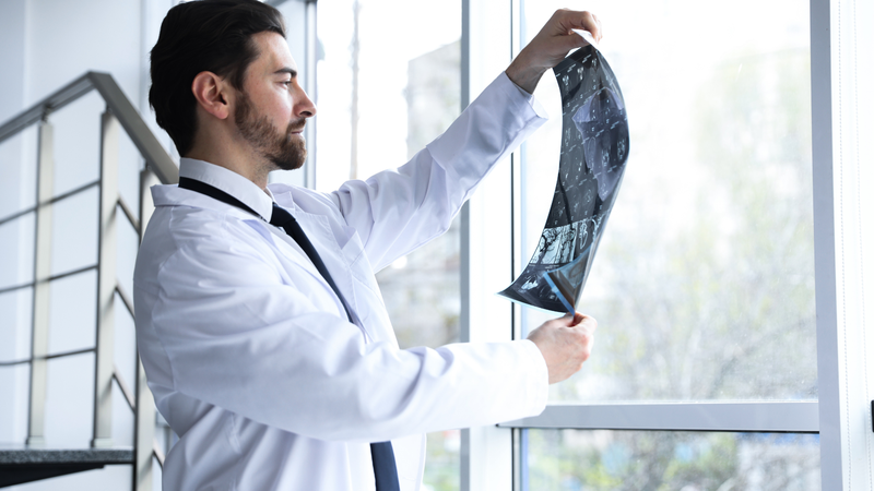 Kết quả MRI sọ não cần được đọc và tư vấn bởi bác sĩ chuyên khoa