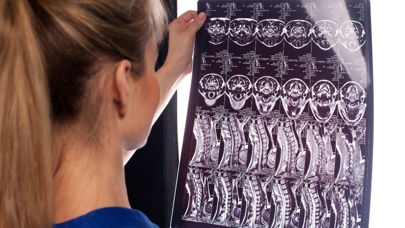 Chụp MRI xương khớp và những điều cần biết 2