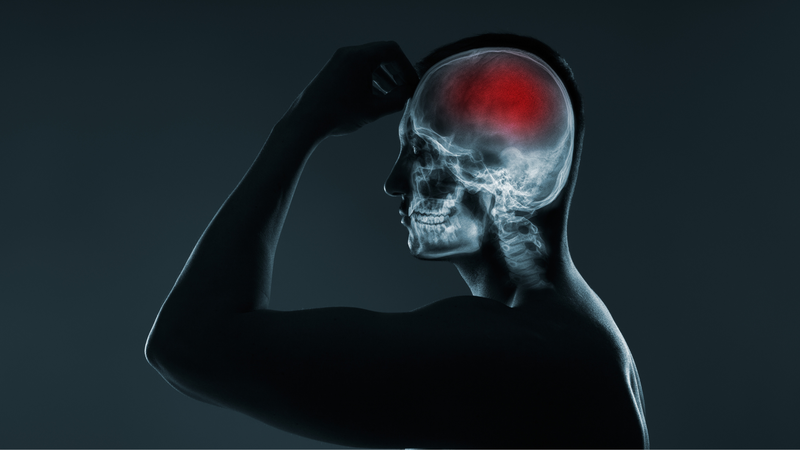 Chụp MSCT có thể phát hiện tổn thương não