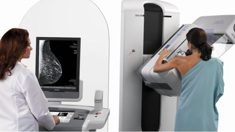Chụp nhũ ảnh có đau không? Những điều cần biết về kỹ thuật chụp nhũ ảnh 3