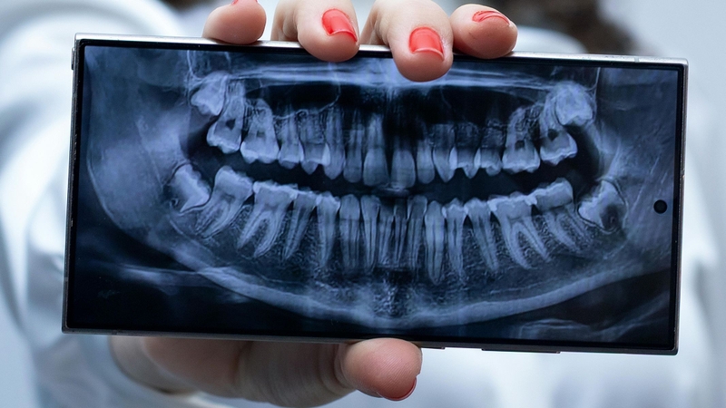 Chụp phim răng hết bao nhiêu tiền?