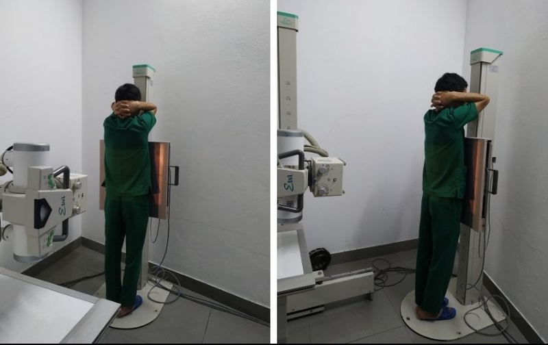 Chụp X quang bụng không chuẩn bị và những điều bạn cần biết 4