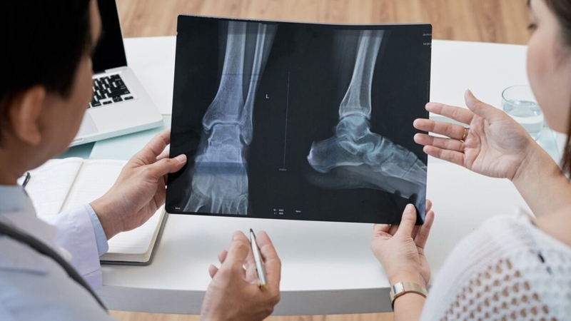 Những điều bạn cần biết về chụp x quang chân 1
