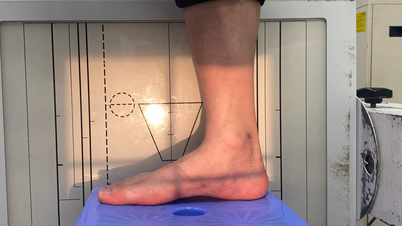 Những điều bạn cần biết về chụp x quang chân 3