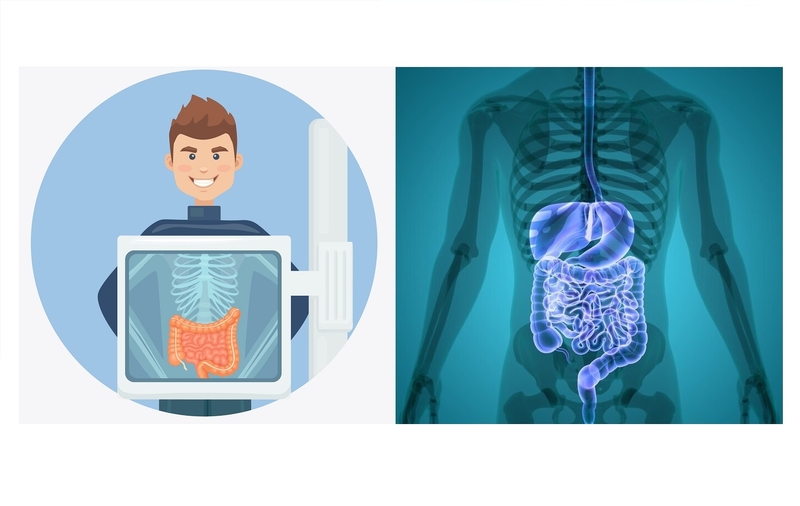 Chụp X - quang đường tiêu hóa: Khi nào cần thực hiện? Quy trình ra sao 1