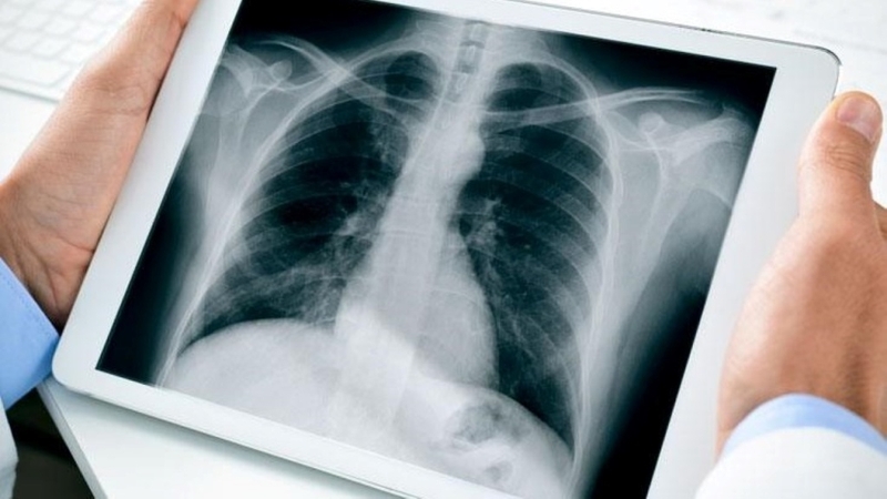 Chụp X quang khi mang thai có an toàn cho thai nhi không? 4