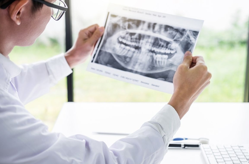 Giúp bạn tìm hiểu về chụp X quang răng toàn cảnh 3