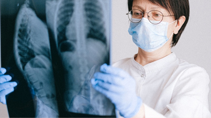 Chụp X quang toàn thân là kỹ thuật dùng tia X để ghi lại hình ảnh tổng quát các bộ phận trong cơ thể