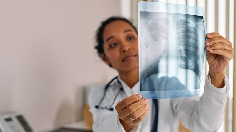 X quang chỉ là một phần của chẩn đoán