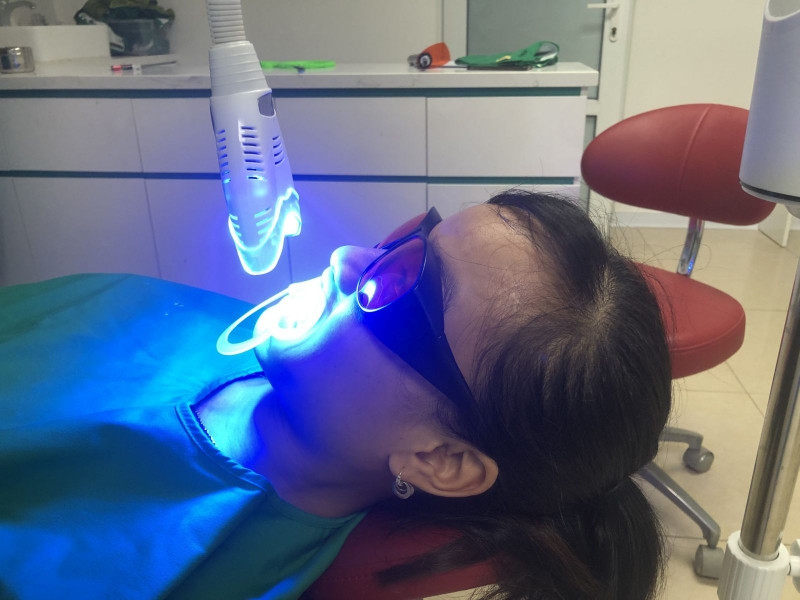 Tẩy trắng răng ở phòng nha