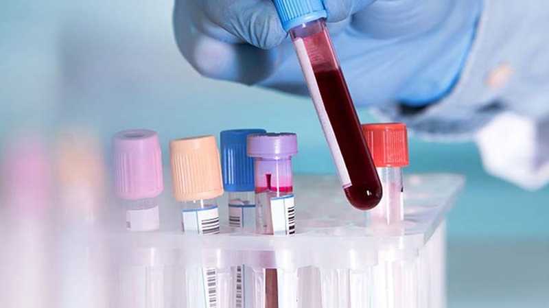 Clo test dương tính là gì? Hiểu rõ về kết quả và ý nghĩa của nó 1