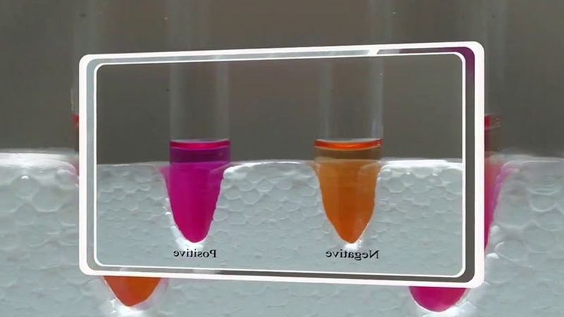 Clo test dương tính là gì? Hiểu rõ về kết quả và ý nghĩa của nó 2