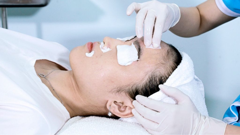 Có bao nhiêu loại peel da? Lưu ý gì khi thực hiện 3