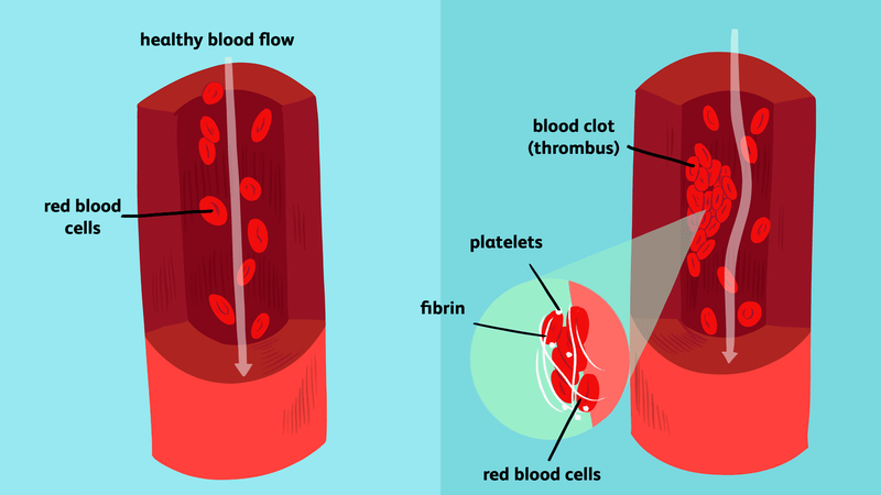 Có bao nhiêu xét nghiệm đông máu cơ bản? 1