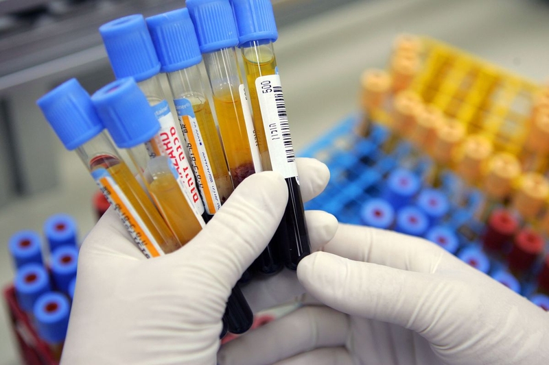 Có cách nào chẩn đoán u tế bào mầm ở trẻ em không - Tìm hiểu ngay! 3