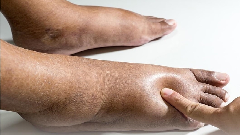 Cơ chế suy tim và những điều cần biết dành cho bệnh nhân 4